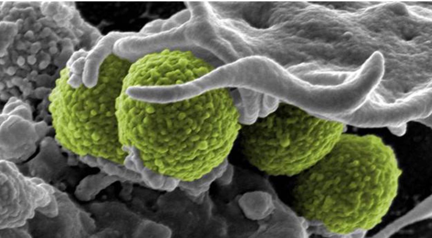 Host Pathogen Interactions